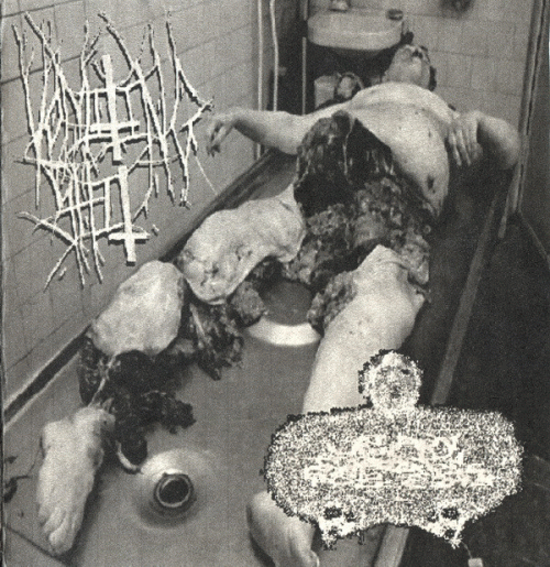 Urinary Tract Infection From Severe Pus Clots : Vomiting Shit - Urinary Tract Infection From Severe Pus Clots